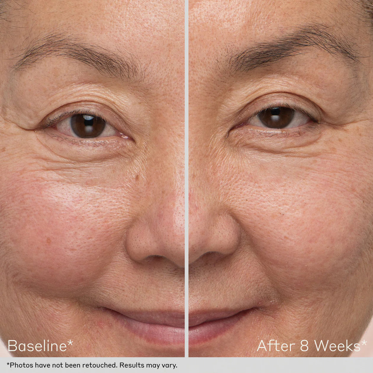 Nu-Cil™ Eyebrow Boosting Serum