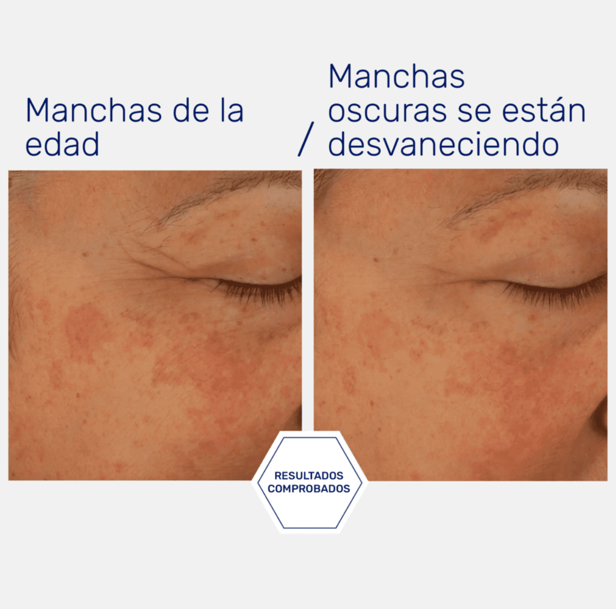 POTENT RETINOL COMPLEX 0.3%