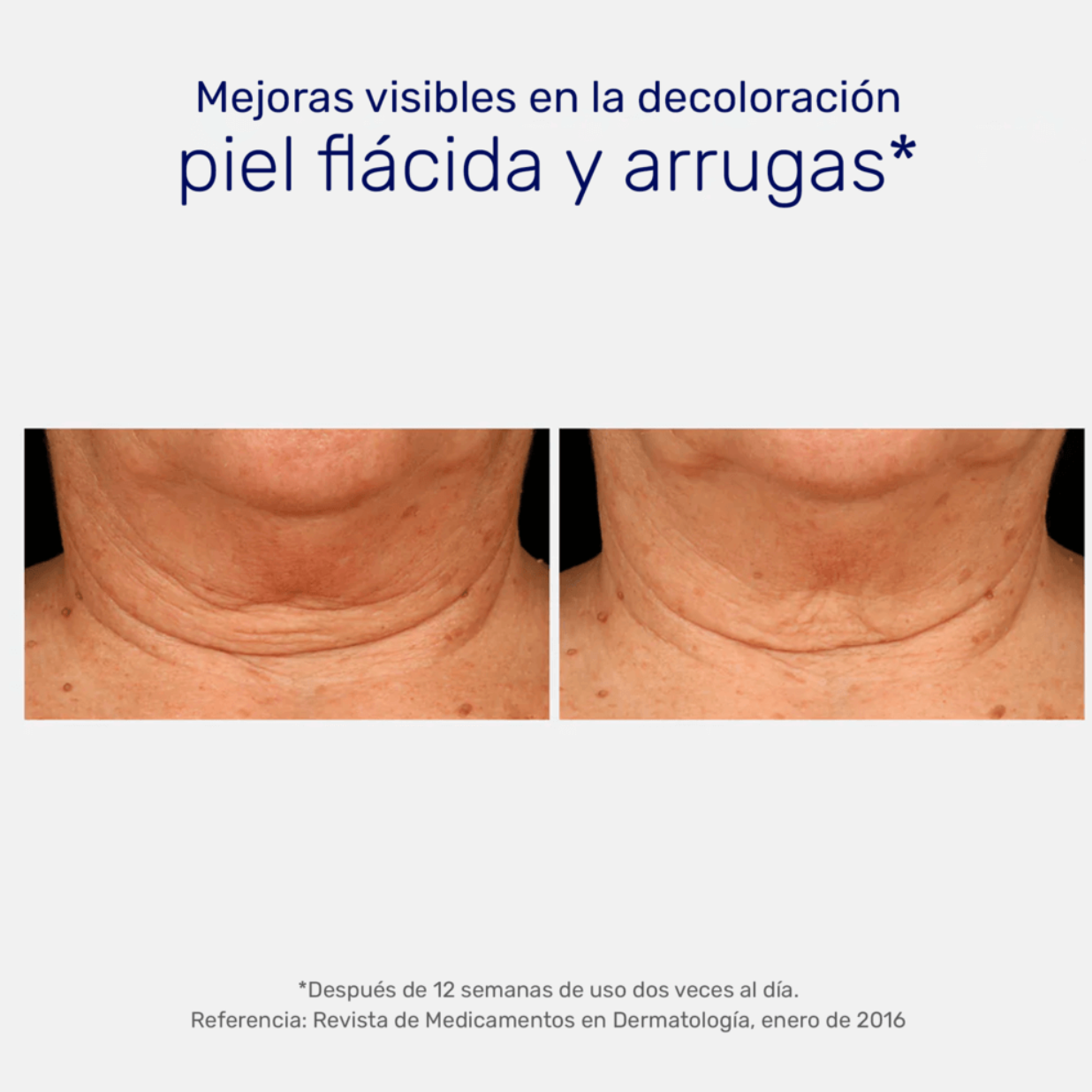 NEOSTRATA Skin Active Triple Firming Neck Cream con MicroDipéptido229, 80 grs
