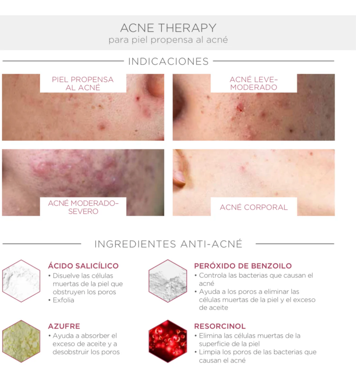 Acne Back & Chest Treatment Spray