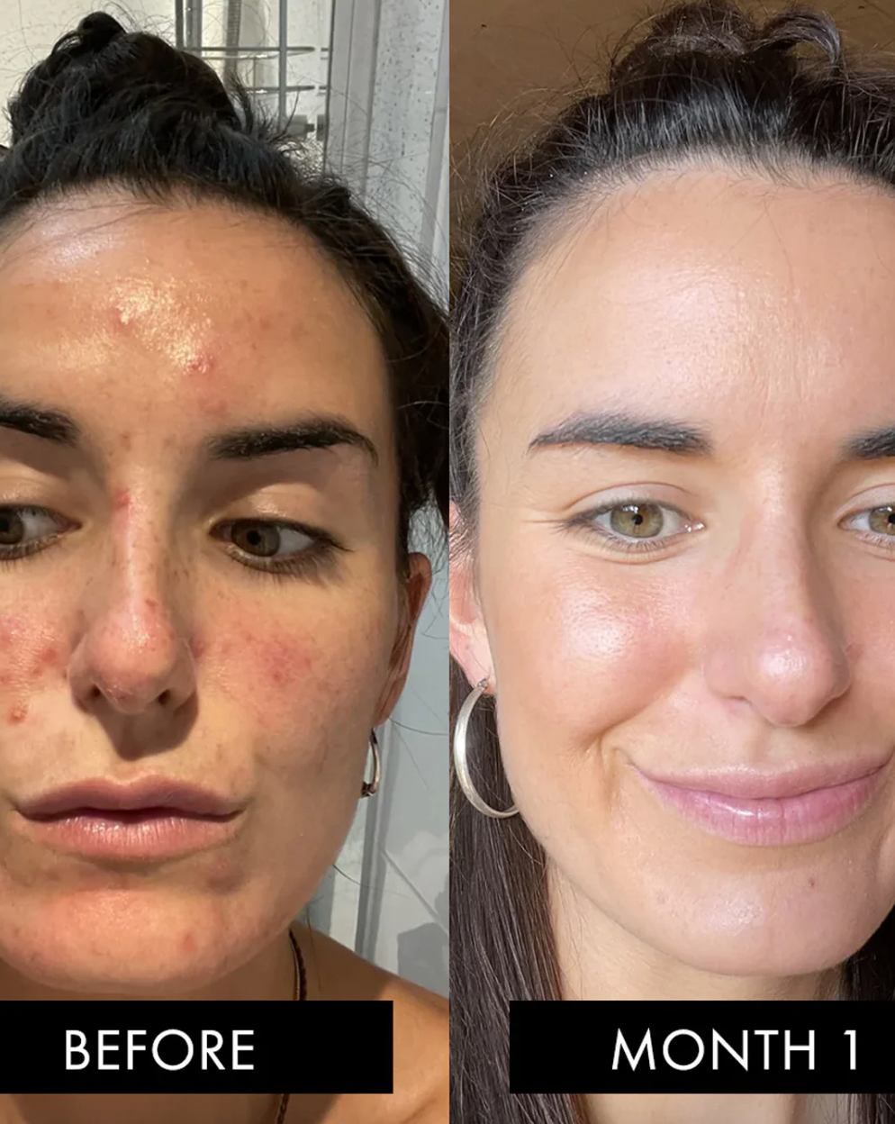 The Skin Elixir
