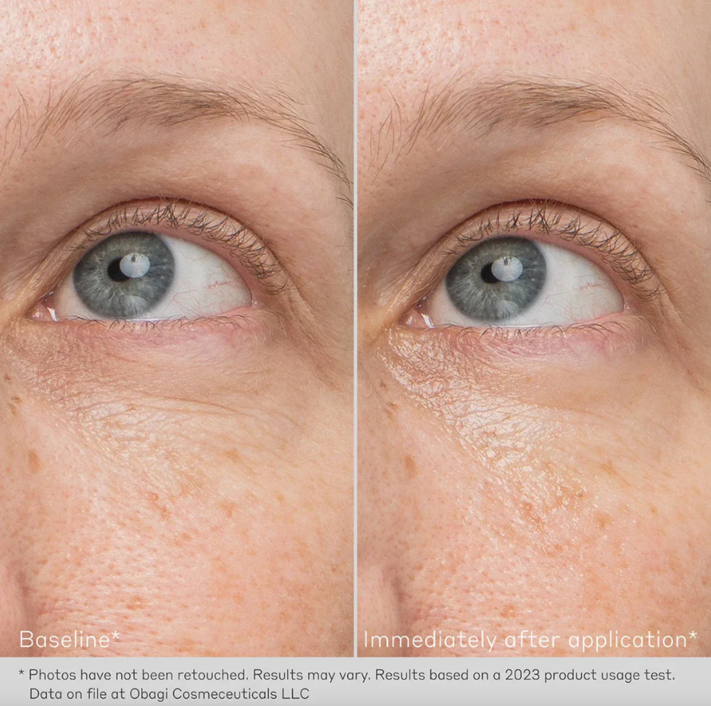 Daily Hydro-Drops Eye Gel Cream - Obagi