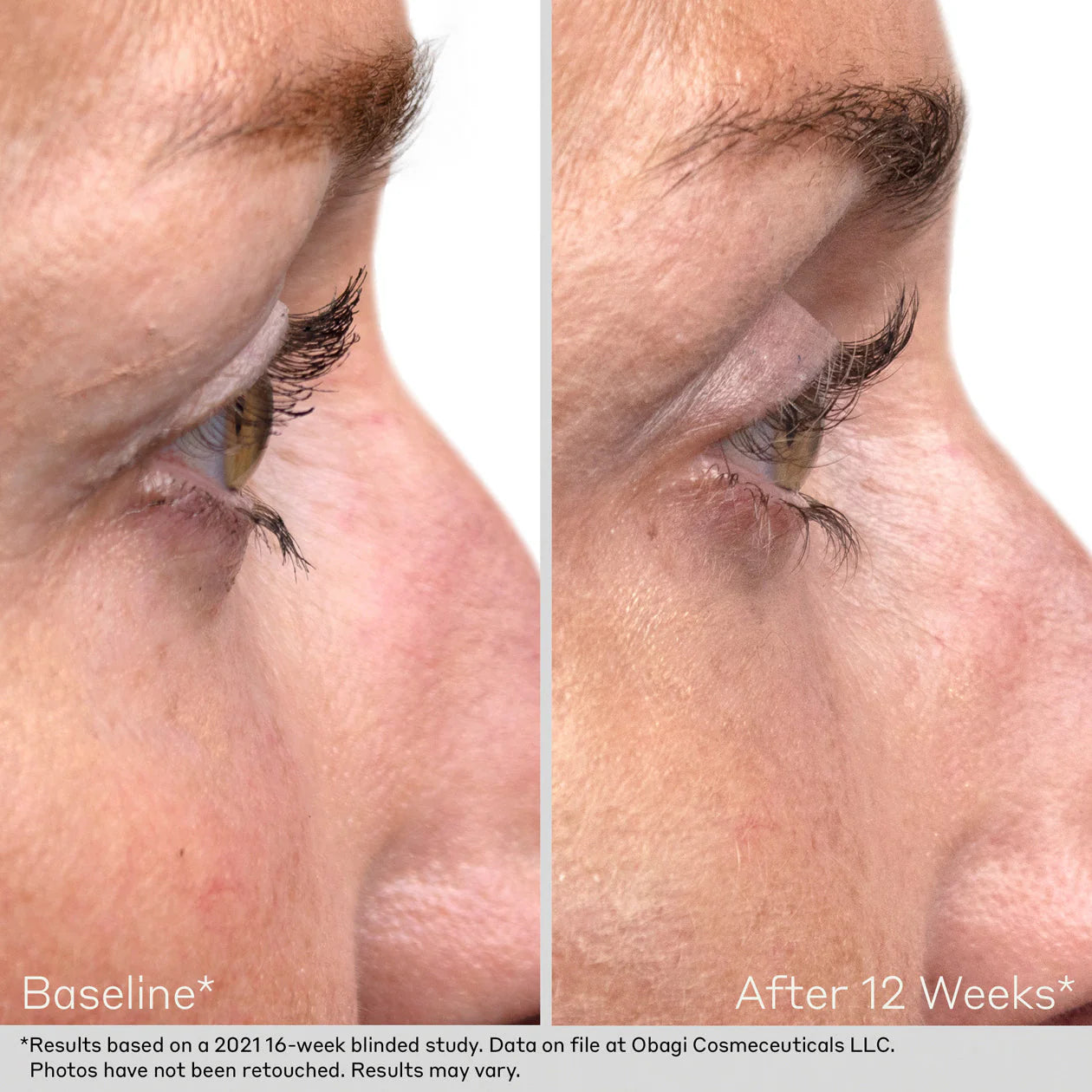 Nu-Cil™ Eyelash Enhancing Serum