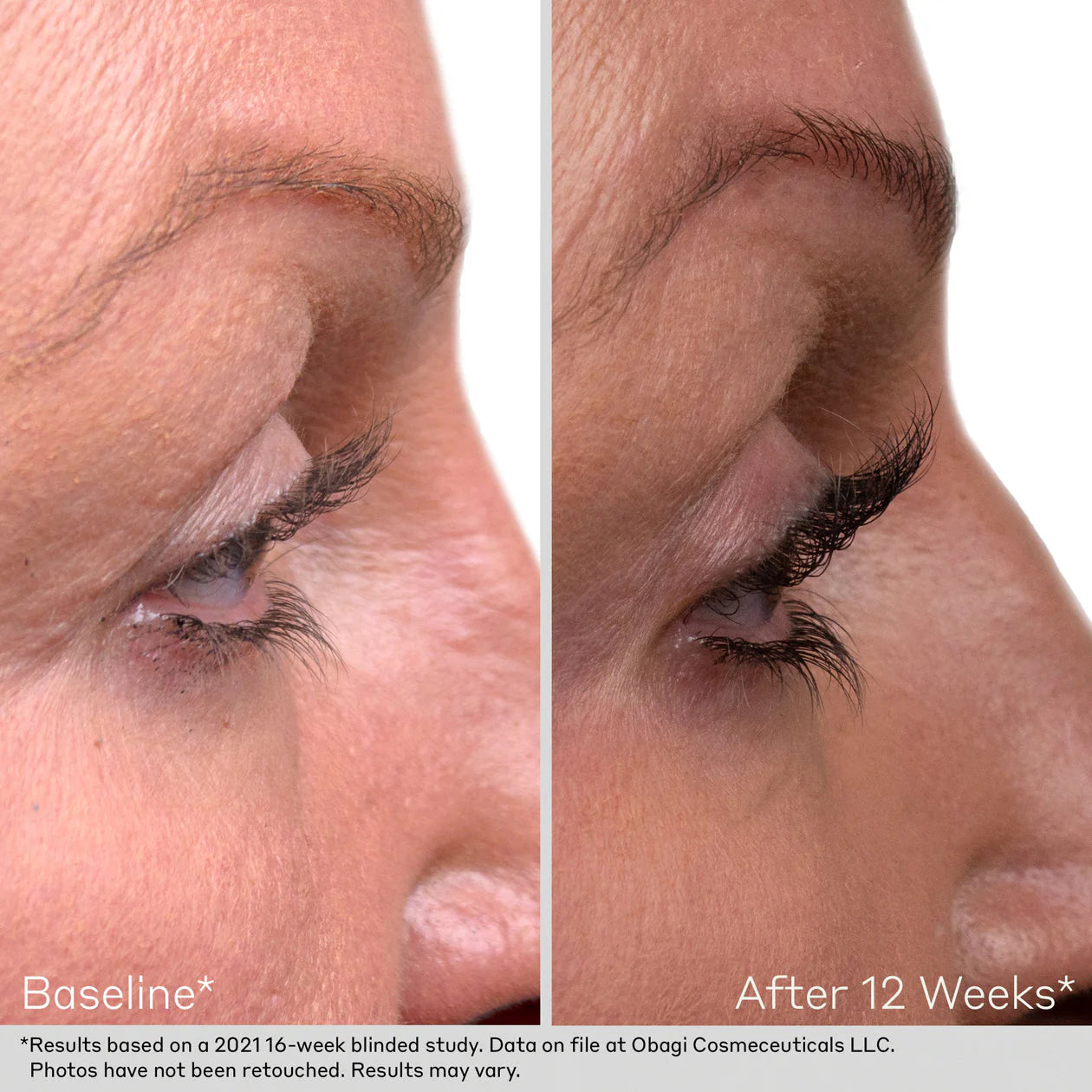 Nu-Cil™ Eyelash Enhancing Serum